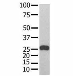 GST Tag antibody used in western blot with recombinant protein