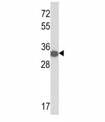 Western blot analysis of anti-His Tag antibody and a tagged recombinant protein.