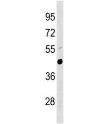 Urokinase antibody western blot analysis in mouse lung tissue lysate.