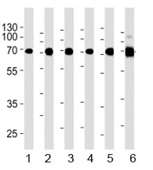 Acetylcholinesterase antibody western blot analysis in 1) human Raji, 2) human Jurkat, 3) human COS7, 4) mouse NIH3T3, 5) mouse cerebellum, and 6) rat cerebellum lysate. Predicted molecular weight ~68 kDa.