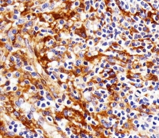 Immunohistochemical analysis of paraffin-embedded human tonsil using FYN antibody at 1:25 dilution.