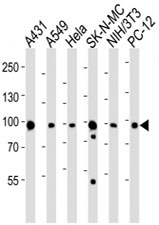 Western blot analysis of lysate from A431, A549, HeLa, SK-N-MC, mouse NIH3T3, rat PC-12 cell line using HSP90 antibody at 1:1000.