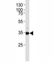 Western blot analysis of lysate from HUVEC cell line using Gapdh antibody. Ab was diluted at 1:1000. Predicted molecular weight ~36kDa.