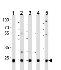Western blot analysis of lysate from HeLa (1), HepG2 (2), Jurkat (3), mouse liver (4) , rat kidney  (5) lysate using UBB/ Ubiquitin antibody at 1:1000.