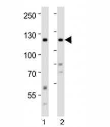 Western blot analysis of lysate from 1) human HeLa and 2) human SH-SY5Y cell line using Ror2 antibody at 1:1000.