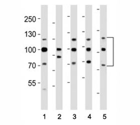 Western blot analysis of lysate from (1) HeLa, (2) HepG2, (3) MCF-7, (4) SH-SY5Y, (5) mouse NIH3T3 cell line using FGFR antibody at 1:1000. Predicted molecular weight: 75-160 kDa depending on glycosylation level.