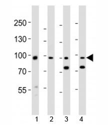 Western blot analysis of lysate from 1) human A431, 2) mouse NIH3T3 cell line, 3) mouse brain and 4) rat brain tissue lysate using Ephb1 antibody at 1:1000.