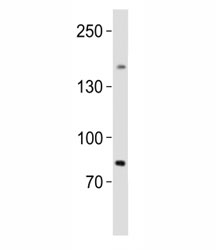 Western blot analysis of lysate from human testis tissue lysate using SALL4 antibody diluted at 1:1000. Predicted molecular weight of isoforms A: 112~165 kDa and B: 65~95 kDa.