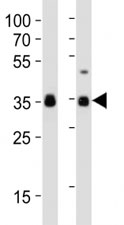Western blot analysis of lysate from human NCCIT, mouse F9 cell line (left to right) using anti-SOX2 antibody at 1:1000 for each lane.