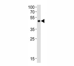 Western blot analysis of lysate from mouse cerebellum tissue lysate using Pax6 antibody diluted at 1:1000. Predicted molecular weight ~48kDa.