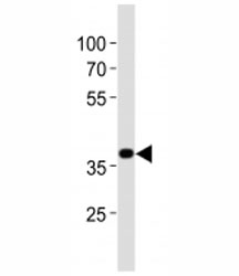 Western blot analysis of lysate from mouse stomach tissue lysate using Nkx2.5 antibody at 1:1000.