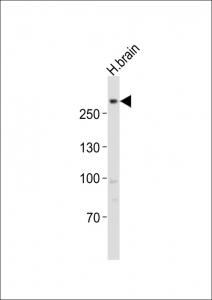 Western blot testing of LRRK2 antibody at 1:1000 dilution + human brain lysate