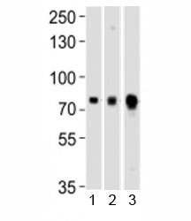 Western blot testing of Melk antibody at 1:1000 dilution and mouse 1) ovary, 2) spleen and 3) testis lysate; Predicted molecular weight ~ 73 kDa.