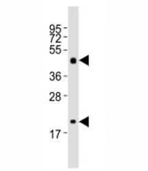 Western blot testing of Shh antibody at 1:2000 dilution + mouse stomach lysate; Predicted molecular weight: 45/27/19 kDa (1)
