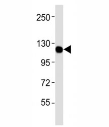 Western blot testing of CSF1R antibodyat 1:4000 dilution + U-87MG lysate; Predicted molecular weight: 106-116 kDa.