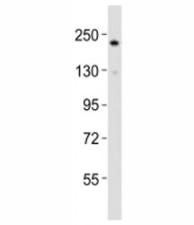 Western blot testing of RICTOR antibody at 1:2000 dilution + HepG2 lysate; Predicted molecular weight ~200 kDa.