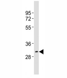Western blot testing of HES1 antibody at 1:2000 dilution + mouse brain lysate; Predicted molecular weight: 30-35 kDa.