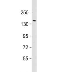 Western blot testing of human brain lysate with RTN4 antibody at 1:2000. Predicted molecular weight ~130 kDa but may be observed at up to ~220 kDa.