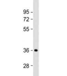 Western blot testing of human brain lysate with NMNAT1 antibody at 1:2000. Predicted molecular weight: 32 kDa, commonly observed at 28-36 kDa.