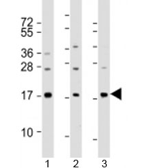 Western blot testing of human 1) A549, 2) HeLa and 3) spleen lysate with PLA2 antibody at 1:2000. Predicted molecular weight: 16 kDa.