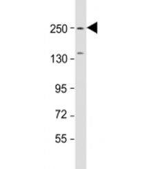 Western blot testing of mouse brain lysate with SPTBN1 antibody at 1:1000. Predicted molecular weight: 275 kDa.