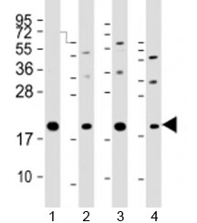 Western blot testing of human 1) HeLa, 2) PC-3, 3) T47D and 4) U-2OS cell lysate with APC11 antibody at 1:2000. Predicted molecular weight: ~10 kDa (Q9NYG5-1) or ~20 kDa (Q9NYG5-2).