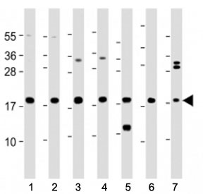 Western blot testing of ARPC5 antibody at 1:2000 with human lysates 1: THP-1, 2: HL-60, 3: HeLa, 4: MCF-7, 5: spleen, 6: mouse brain lysate and 7: rat brain lysate. Predicted molecular weight ~16 kDa.