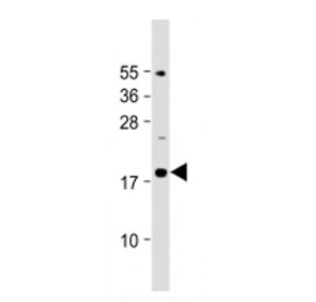 Western blot testing of IL-23 antibody at 1:2000 dilution + mouse pancreas lysate. Predicted molecular weight ~21 kDa, observed molecular weight ~19 kDa.