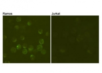 ICC/IF testing of Ramos cells (positive cell line, left) and Jurkat cells (negative cell line, right) using CD19 antibody at 1:100.