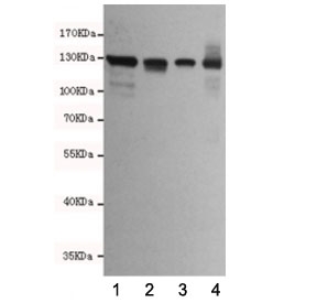 Western blot testing of human 1) T47D, 2) HCT116, 3) MDA-MB-468 and 4) Caco-2 cell lysates using E-Cadherin antibody at 1:2000. Expected molecular weight: 135 kDa (precursor), 80-120 kDa (mature, depending on glycosylation level).