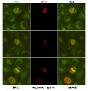 ICC/IF analysis of HeLa cells, fixed fixed by anhydrous methanol at -20oC, using SIRT2 antibody at 1:50 (green) and Histone H3.1 (pSer10) antibody at 1:200 (red).