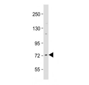 Western blot testing of Raf1 antibody at 1:2000 + human MCF7 cell lysate. Predicted molecular weight ~73 kDa.