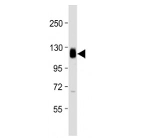 Western blot testing of Thrombomodulin antibody at 1:2000 + human THP1 cell lysate. Expected molecular weight ~60/100 kDa (unmodified/glycosylated).