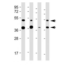 Western blot testing of FDPS antibody at 1:2000: Lane 1) human HeLa, 2) (h) HepG2, 3) (h) U-251 MG and 4) mouse liver lysate. Predicted molecular weight ~48 kDa (isoform 1) and ~40 kDa (isoform 2).