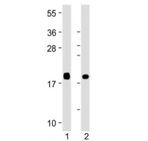 Western blot testing of VILIP1 antibody at 1:4000: Lane 1) human brain and 2) human cerebellum lysate. Predicted molecular weight ~22 kDa.