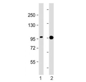 Western blot testing of SSH3 antibody at 1:2000: Lane 1) human A431 and 2) ZR-75-1 cell lysate. Predicted molecular weight ~73 kDa, can be observed at 90-95 kDa.