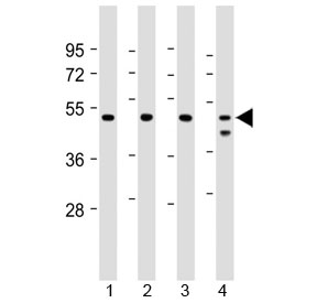 Western blot testing of human 1) Jurkat, 2) U-2 0S, 3) HeLa and 4) MCF7 cell lysate with PSMC2 antibody at 1:2000. Predicted molecular weight ~49 kDa.