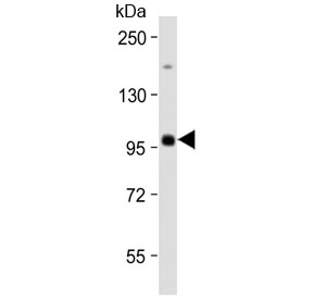 Western blot testing of human Raji cell lysate with MAP4K1 antibody at 1:2000. Predicted molecular weight ~91 kDa.