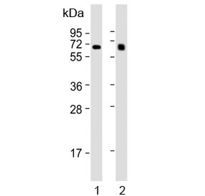 Western blot testing of human 1) liver and 2) lung lysate with IDUA antibody. Expected molecular weight: 74-85 kDa.