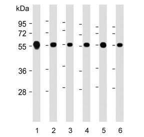 Western blot testing of human 1) Jurkat, 2) HeLa, 3) K562, 4) SH-SY5Y, 5) Ramos and 6) A549 cell lysate with CALR antibody. Expected molecular weight: 46-55 kDa.