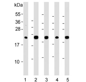 Western blot testing of human 1) liver, 2) HepG2, 3) 293T, 4) kidney and 5) ThP-1 lysate with GPX1 antibody. Predicted molecular weight ~22 kDa.