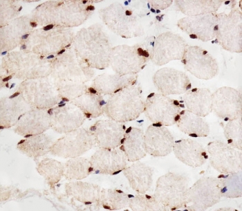 IHC testing of FFPE human skeletal muscle tissue with PPARA antibody. HIER: steam section in pH6 citrate buffer for 20 min and allow to cool prior to staining.