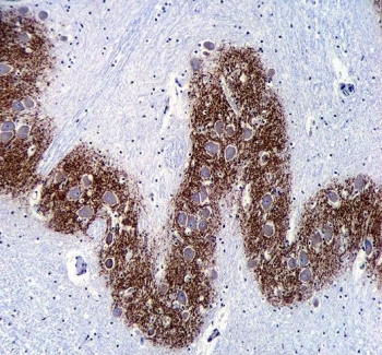 IHC testing of FFPE human brain tissue with Synaptophysin antibody. HIER: steam section in pH6 citrate buffer for 20 min and allow to cool prior to staining.