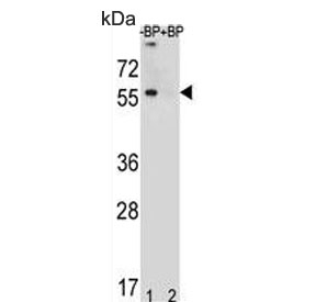 Western blot testing of human MDA-MB453 lysate in the absence and presence of immunizing peptide, using TOX-3 antibody. Predicted molecular weight ~63 kDa.