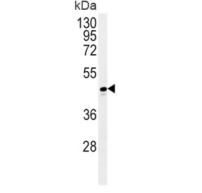 Western blot testing of human T-47D cell lysate with ADH1C antibody. Predicted molecular weight ~40 kDa.