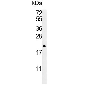 Western blot testing of human NCI-H460 cell lysate with PTP4A2 antibody. Predicted molecular weight ~19 kDa.