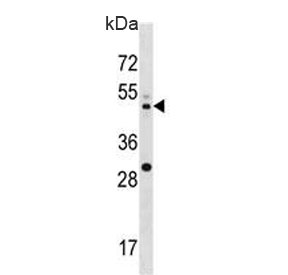 Western blot testing of human U937 cell lysate with MEK2 antibody. Expected molecular weight: 45-50 kDa.