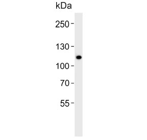 Western blot testing of human WiDr cell lysate with CARD6 antibody. Predicted molecular weight ~116 kDa.