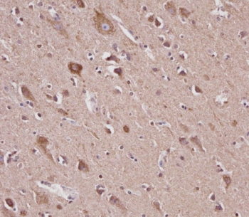 IHC testing of FFPE human brain tissue with VDAC2 antibody. HIER: steam section in pH6 citrate buffer for 20 min and allow to cool prior to staining.
