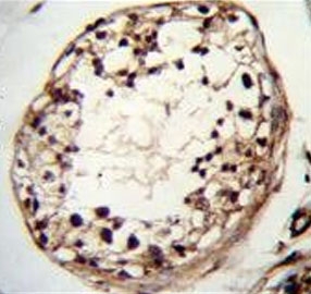 IHC testing of FFPE human testis tissue with TSPYL6 antibody. HIER: steam section in pH6 citrate buffer for 20 min and allow to cool prior to staining.